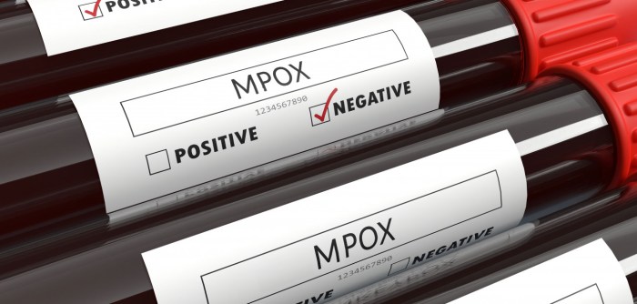 Mpox In Africa: Sierra Leone Declares Public Health Emergency Over Mpox ... Sierra leone mpox outbreak pardis sabeti christian happi essay