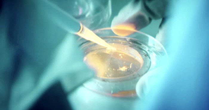 IVF Solution Scandal Rocks Fertility Industry | Lawsuit Legit ... Second australian ivf mix up shakes clinic industry