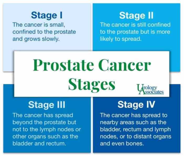 What Is The Best Treatment For Gleason 9 Prostate Cancer at Jason ... Biden prostate cancer diagnosis gleason score stage survival treatment explainer