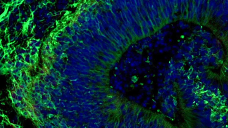 Johns Hopkins Scientists Uncover Promising New Pathway for Personalized Alzheimer’s Treatment Using Mini Brain Models