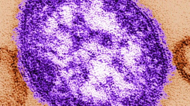 Coroner confirms measles-related infant deaths in Pennsylvania amid national political scrutiny