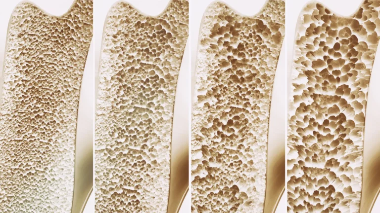 New Research Into GPR133 Receptor Reveals Breakthrough Potential for Treating Osteoporosis and Muscle Loss