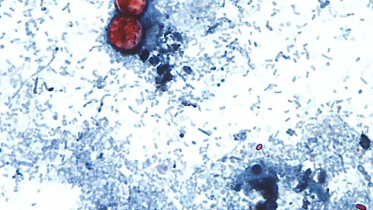 The Largest Cyclospora Food Poisoning Outbreak in United States History Has Officially Concluded