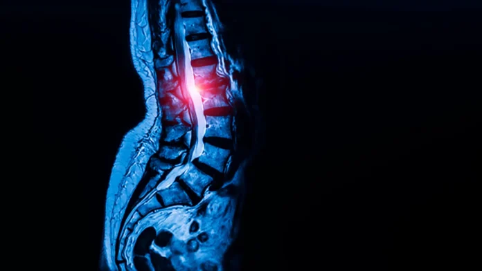 unlocking-the-blueprint-of-movement-researchers-discover-universal-tendon-and-ligament-stem-cells-with-implications-for-spinal-stenosis
