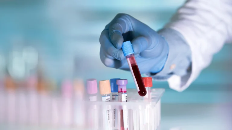 Hidden Immune System Shifts Detect Inflammatory Bowel Disease a Decade Before Clinical Diagnosis
