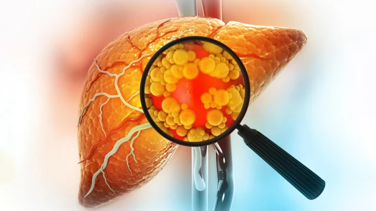 Hormonal Imbalances and Sugary Diets Converge: New Study Links Low Testosterone and Fructose to Severe Fatty Liver Disease